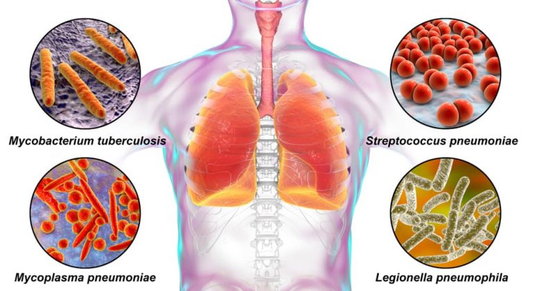 What is the California pneumonia presumption for safety and law enforcement officers