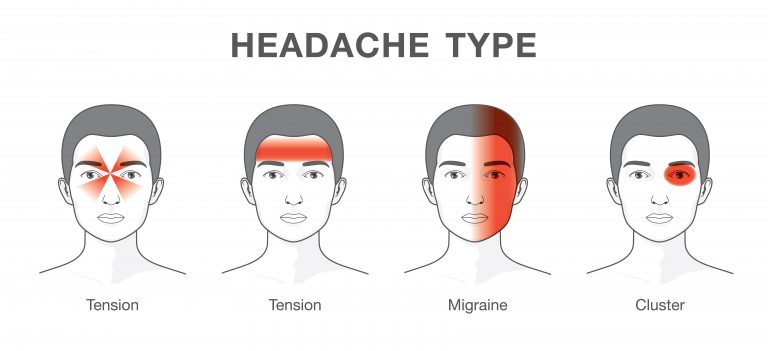 headache injury claims 